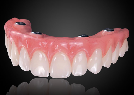 ZIRCONIA FULL ARCH / ONLY FINAL